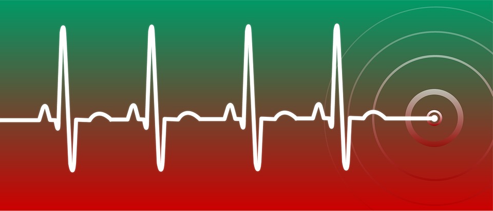 Cardiac Rhythm Management Cambridge