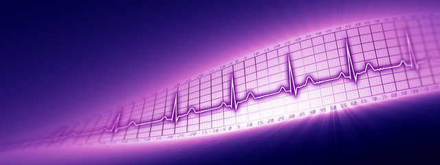 What are the main symptoms of heart rhythm abnormality?