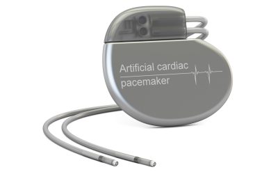 Pacemakers and You: Dispelling Common Myths About Cardiac Devices