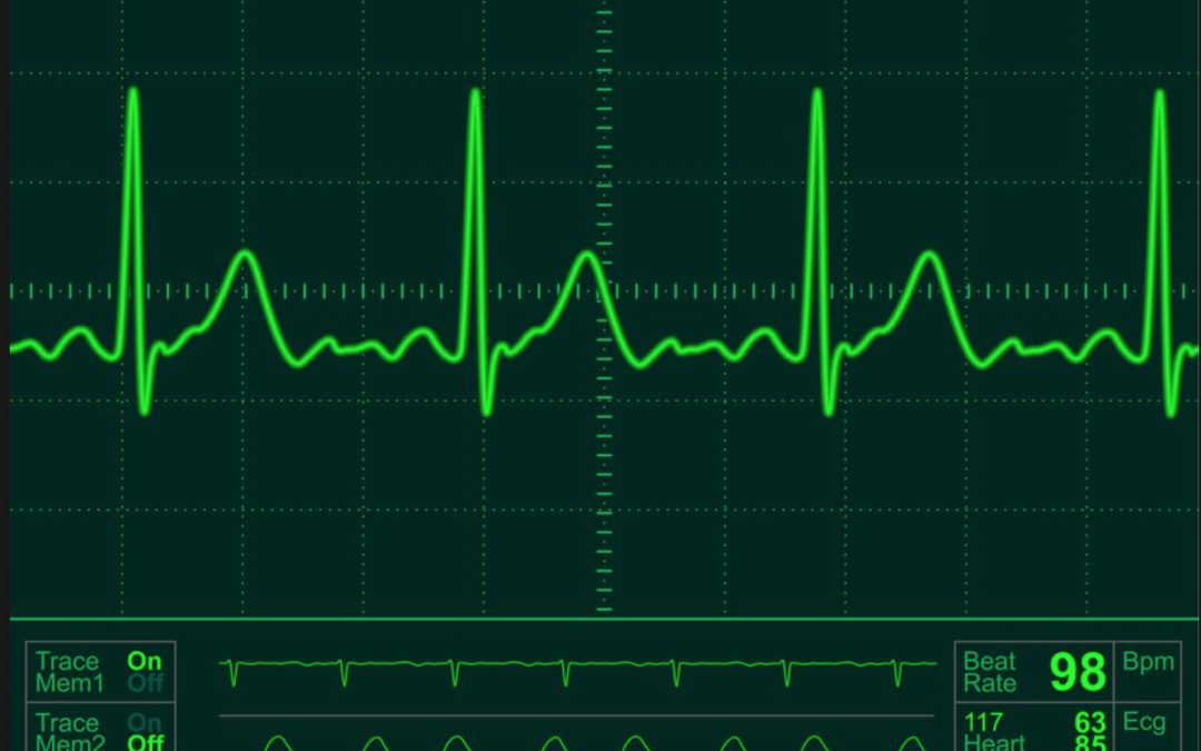 Understanding Heart Rhythm Abnormalities