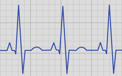 What is Cardiac Rhythm Management?
