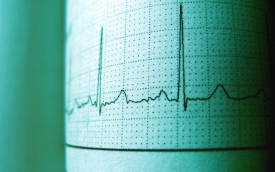 Ventricular Tachycardia Treatment