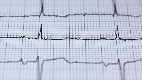 The Role of a Cardiac Rhythm Management Consultant Cambridge