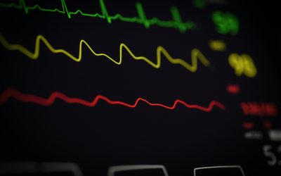 What is an ECG and Why is it Important for Your Heart Health?